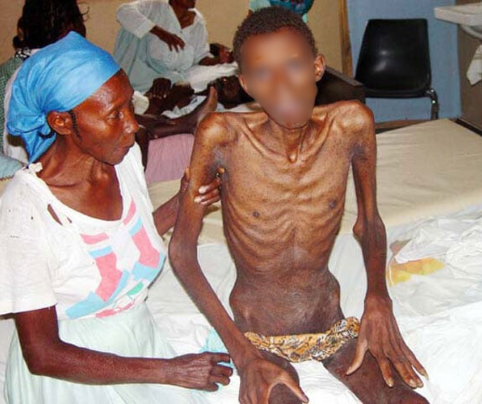 HIV has claimed 44 Million lives globally - WHO warns virus remains major health threat